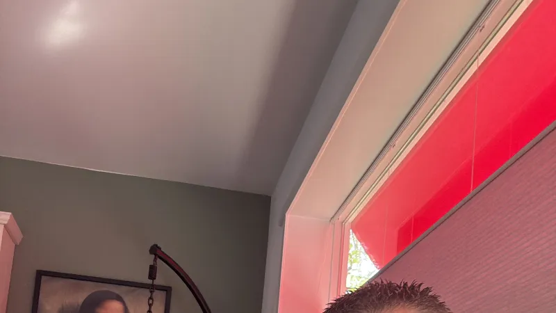 Oppashond